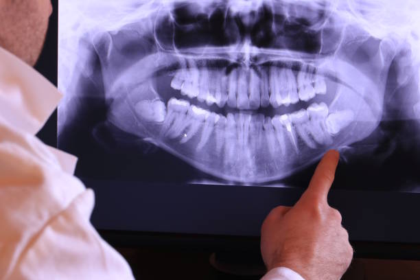 Best Emergency Denture Repair in Mayer, MN